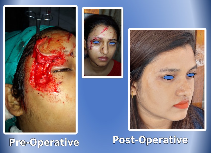 FACIAL INJURY